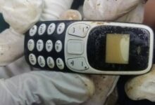 هاتف يعيش داخل جسم مصري لمدة عامين.. تفاصيل القصة