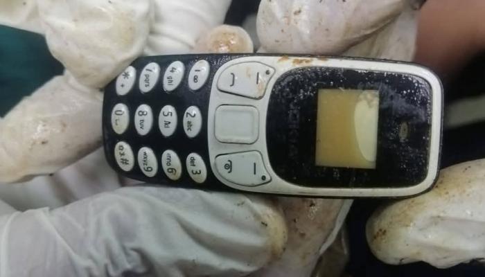 هاتف يعيش داخل جسم مصري لمدة عامين.. تفاصيل القصة 1 هاتف يعيش داخل جسم مصري لمدة عامين.. تفاصيل القصة